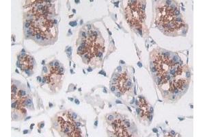 Immunohistochemistry (IHC) image for anti-Myostatin (MSTN) (AA 267-375) antibody (ABIN7433885)