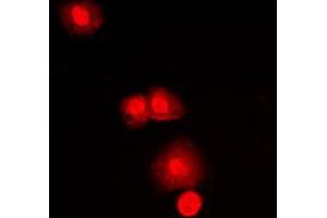 Immunofluorescence (IF) image for anti-Mechanistic Target of Rapamycin (serine/threonine Kinase) (mTOR) (C-Term) antibody (ABIN7295702)