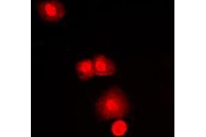 Immunofluorescent analysis of mTOR staining in MCF7 cells. (MTOR 抗体  (C-Term))