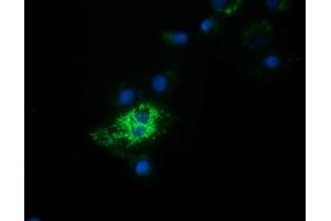 Anti-HIBCH mouse monoclonal antibody (ABIN2453121) immunofluorescent staining of COS7 cells transiently transfected by pCMV6-ENTRY HIBCH (RC209814). (HIBCH 抗体)