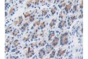Immunohistochemistry (IHC) image for anti-Stromal Cell Derived Factor 4 (SDF4) (AA 184-382) antibody (ABIN7437890)