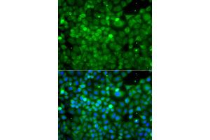 Immunofluorescence analysis of A549 cells using POC1A antibody (ABIN6293867). (POC1A 抗体)