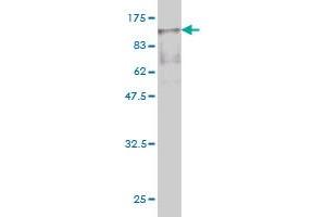 Western Blot detection against Immunogen (89. (Radixin 抗体  (AA 1-583))