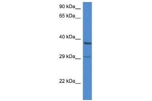 Western Blot showing OGG1 antibody used at a concentration of 1 ug/ml against ACHN Cell Lysate (OGG1 抗体  (C-Term))