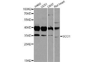 Western blot analysis of extracts of various cell lines, using SCO1 antibody. (SCO1 抗体)