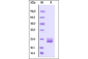 SDS-PAGE (SDS) image for Vascular Endothelial Growth Factor A (VEGFA) (AA 27-146) (Active) protein (His tag,AVI tag,Biotin) (ABIN6809988)