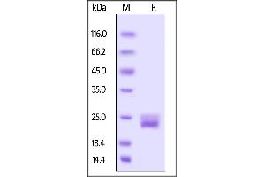 VEGFA Protein (AA 27-146) (His tag,AVI tag,Biotin)