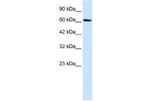 Human Daudi; WB Suggested Anti-UBP1 Antibody Titration: 0. (TFCP2 抗体  (Middle Region))
