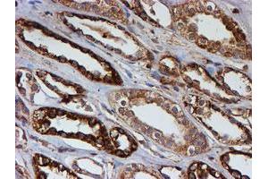 Immunohistochemical staining of paraffin-embedded Human Kidney tissue using anti-PSMB9 mouse monoclonal antibody. (PSMB9 抗体  (AA 21-219))