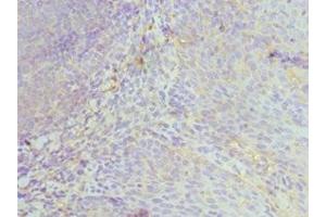 Immunohistochemistry of paraffin-embedded human tonsil tissue using ABIN7174029 at dilution of 1:100 (HCK 抗体  (AA 1-220))