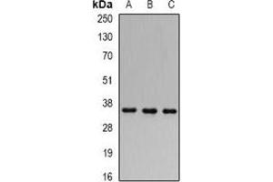 Western blot analysis of FHL-1 expression in 22RV1 (A), MCF7 (B), mouse kidney (C) whole cell lysates. (FHL1 抗体)