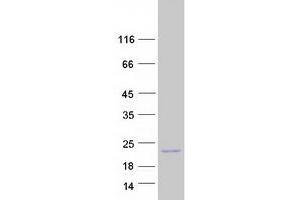 Western Blotting (WB) image for Interleukin 23, alpha subunit p19 (IL23A) protein (Myc-DYKDDDDK Tag) (ABIN2723682)