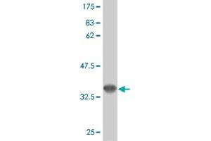 Western Blot detection against Immunogen (36. (FLT4 抗体  (AA 34-133))