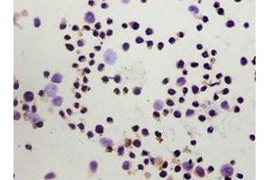 Immunohistochemistry of paraffin-embedded Hela cells using ABIN7153097 at dilution of 1:100 (FOXP3 抗体  (AA 1-260))