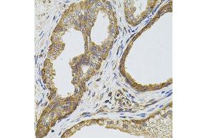 Immunohistochemistry of paraffin-embedded human prostate using EGFR antibody.