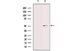 Western Blotting (WB) image for anti-Cytochrome P450, Family 4, Subfamily X, Polypeptide 1 (CYP4X1) antibody (ABIN6258079)