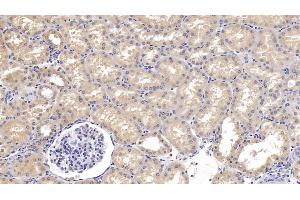 Immunohistochemistry (IHC) image for anti-Sema Domain, Immunoglobulin Domain (Ig), Short Basic Domain, Secreted, (Semaphorin) 3A (SEMA3A) (AA 580-664) antibody (ABIN7428446)
