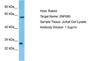 Host: Rabbit Target Name: ZNF680 Sample Type: Jurkat Whole Cell lysates Antibody Dilution: 1. (ZNF680 抗体  (Middle Region))