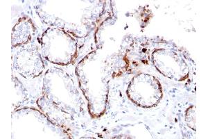 Formalin-fixed, paraffin-embedded human Prostate stained with Cytokeratin 15 Rabbit Recombinant Monoclonal Ab (KRT15/2103R).