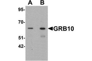 Western blot analysis of GRB10 in SK-N-SH cell lysate with GRB10 Antibody  at (A) 1 and (B) 2 µg/ml. (GRB10 抗体  (C-Term))