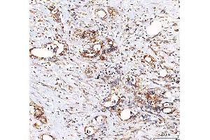 IHC analysis of EML4 using anti-EML4 antibody (ABIN6719384).