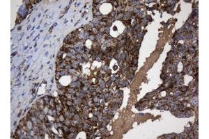 Image no. 4 for anti-NADH Dehydrogenase (Ubiquinone) 1 beta Subcomplex, 10, 22kDa (NDUFB10) antibody (ABIN1499672) (NDUFB10 抗体)