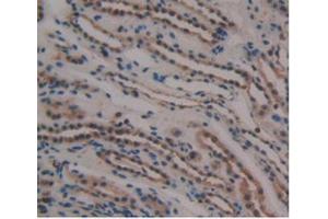 IHC-P analysis of Human Kidney Tissue, with DAB staining. (GDF3 抗体  (AA 251-364))