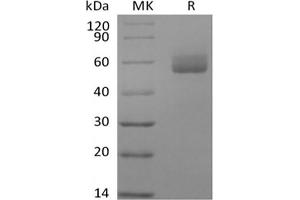 GPIHBP1 Protein (Fc Tag)