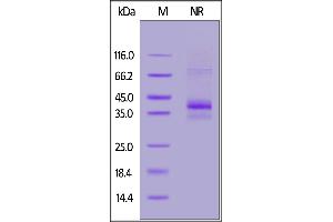 SDS-PAGE (SDS) image for Chemokine (C-C Motif) Receptor 5 (CCR5) (AA 2-223), (AA 227-319) (Active) protein (His tag,DYKDDDDK Tag) (ABIN7013588)