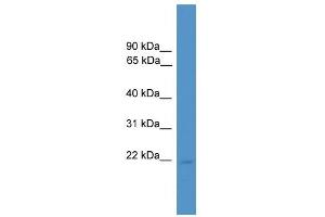 WB Suggested Anti-RHOXF1 Antibody Titration:  0. (RHOXF1 抗体  (C-Term))