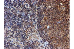 Image no. 9 for anti-Histidyl-tRNA Synthetase 2, Mitochondrial (Putative) (HARS2) antibody (ABIN1498584)