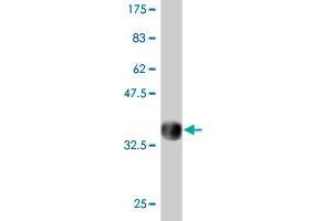 Western Blot detection against Immunogen (31. (DAZ3 抗体  (AA 387-438))