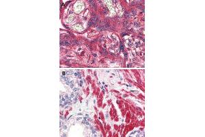 Immunohistochemical (Formalin/PFA-fixed paraffin-embedded sections) staining in human placenta (A) and human prostate (B) with OR51E1 polyclonal antibody . (OR51E1 抗体  (Internal Region))