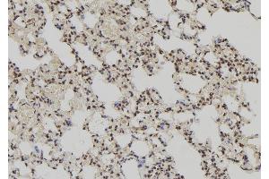 ABIN6279694 at 1/100 staining Rat lung tissue by IHC-P. (PPP1R2P3 抗体)