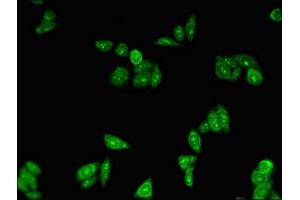 Immunofluorescent analysis of HepG2 cells using ABIN7162891 at dilution of 1:100 and Alexa Fluor 488-congugated AffiniPure Goat Anti-Rabbit IgG(H+L) (PLIN3 抗体  (AA 192-324))