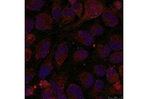 Immunofluorescence staining of methanol-fixed Hela cells using GATA1(Phospho-Ser142) Antibody. (GATA1 抗体  (pSer142))
