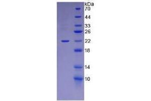 SDS-PAGE analysis of Mouse Laminin alpha 1 Protein. (Laminin alpha 1 蛋白)