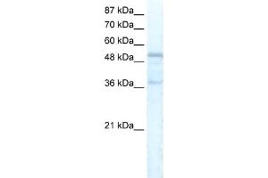 WB Suggested Anti-FOXC1 Antibody Titration:  5. (FOXC1 抗体  (C-Term))