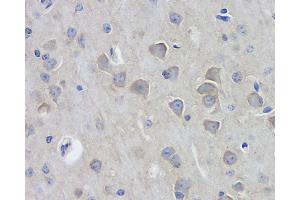 Immunohistochemistry analysis of paraffin-embedded mouse brain using DLG4 Polyclonal Antibody at dilution of 1:100. (DLG4 抗体)