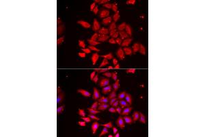 Immunofluorescence analysis of U2OS cells using TMOD4 antibody. (Tropomodulin 4 抗体)