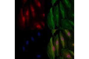 ABIN6264011 and ABIN6278159 staining  cells by IF/ICC.