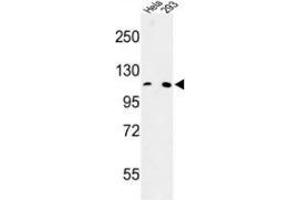Western blot analysis of MTTP (arrow) in Hela, 293 cell line lysates (35ug/lane) using MTTP Antibody (C-term). (MTTP 抗体  (C-Term))