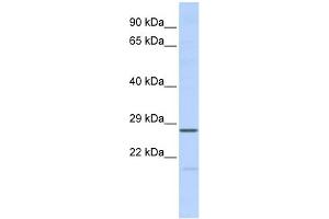 WB Suggested Anti-MED6 Antibody Titration:  0.