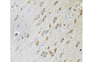 Immunohistochemistry of paraffin-embedded Rat brain using MT-ND5 Polyclonal Antibody at dilution of 1:100 (40x lens). (MT-ND5 抗体)