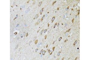Immunohistochemistry of paraffin-embedded Rat brain using MT-ND5 Polyclonal Antibody at dilution of 1:100 (40x lens).
