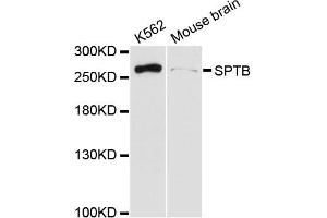 Western blot analysis of extracts of various cell lines, using SPTB antibody (ABIN6290966) at 1:3000 dilution. (Spectrin beta Chain, Erythrocyte (SPTB) 抗体)