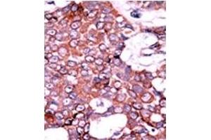 Image no. 2 for anti-Cell Division Cycle 25 Homolog A (S. Pombe) (CDC25A) (pSer76) antibody (ABIN358097) (CDC25A 抗体  (pSer76))