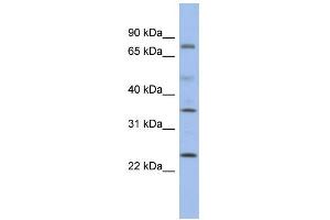 Western Blotting (WB) image for anti-Protein Phosphatase, Mg2+/Mn2+ Dependent, 1K (PPM1K) (Middle Region) antibody (ABIN2785199)