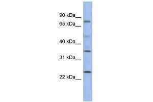 WB Suggested Anti-PPM1K Antibody Titration: 0. (PPM1K 抗体  (Middle Region))