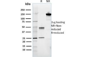 SDS-PAGE Analysis Purified ROR2 Mouse Monoclonal Antibody (ROR2/1911). (ROR2 抗体)